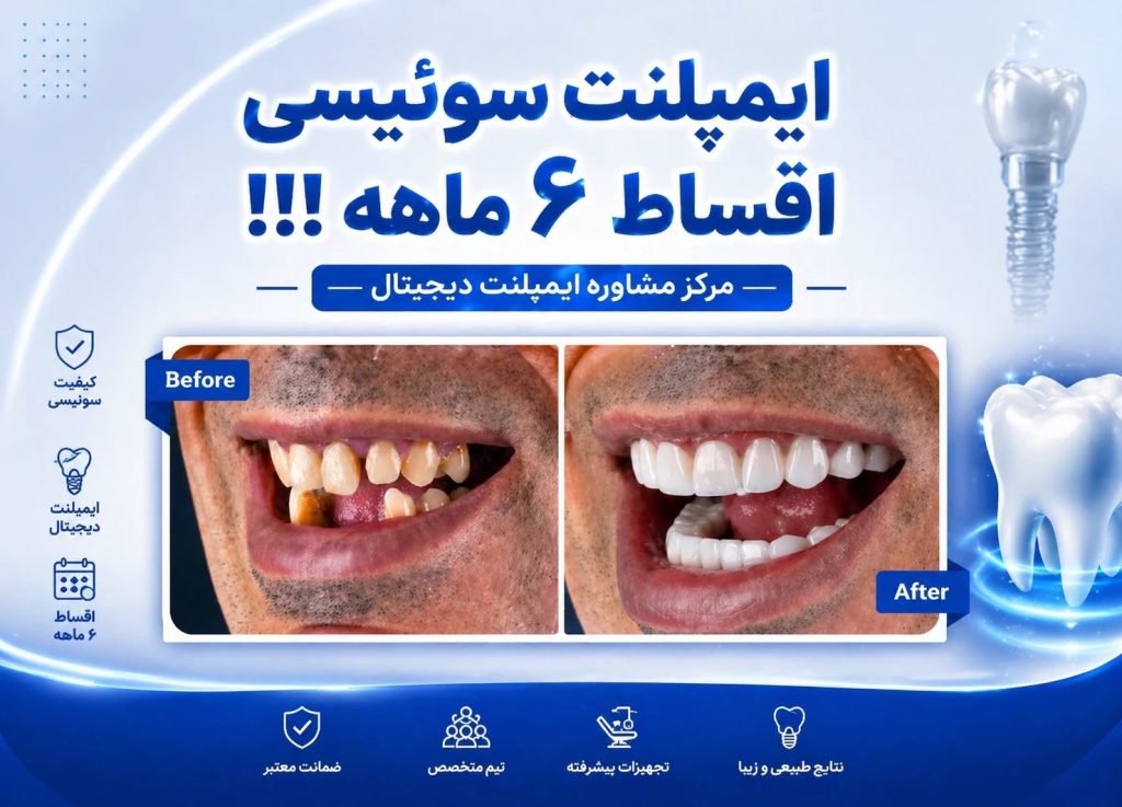 مشاوره دندان دیجیتال